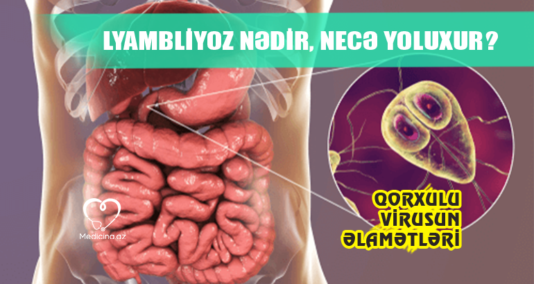 Lyambliyoz nədir, necə yoluxur?  – QORXULU VİRUSUN ƏLAMƏTLƏRİ