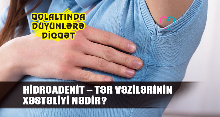 Hidradenit – tər vəzilərinin xəstəliyi nədir?  -  Ülgüclə qolaltını zədələməyin fəsadı