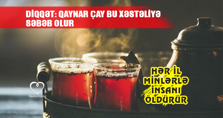 qaynar çay bu xəstəliyə səbəb olur – HƏR İL MİNLƏRLƏ İNSANI ÖLDÜRÜR DİQQƏT: 