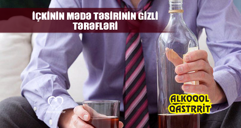 Alkoqol qastriti –  İçkinin mədəyə zərərinin klinikası və müalicəsi