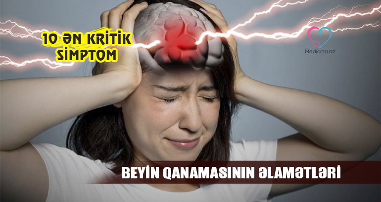 Beyin qanamasının əlamətləri – 10 ən kritik simptom 