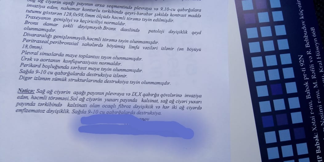 Qulunc ağrısına görə həkimə gələn kişinin ağciyərində şiş tapıldı  –  Azərbaycanda nevroloqdan xəstəni şok edən diaqnoz