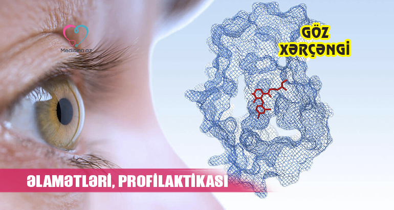 Göz xərçəngi - əlamətləri, profilaktikası  