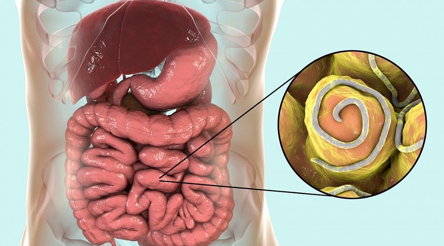 Qurd və yumurtalarına görə analizlər –  Hansı daha dəqiqdir?