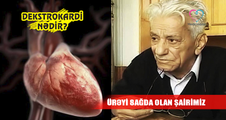 Ürəyi sağda olan şairimiz  – Dekstrokardi nədir?