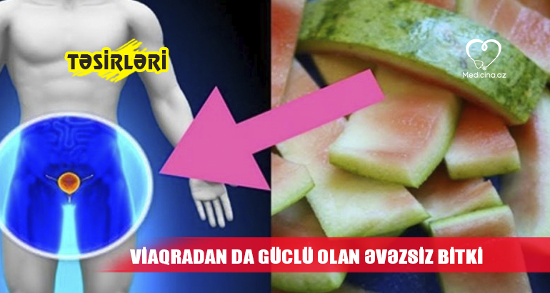 Viaqradan da güclü olan əvəzsiz bitki 