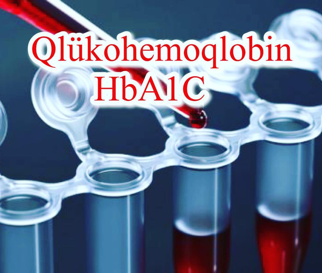 Qlikohemoqlobin analizi nədir? -  Son 3 ayda qanda şəkərin səviyyəsini yoxladın