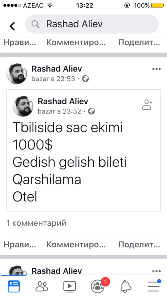 Bakıda onlarla kişinin başında uğursuz saç əkən həkim Tiflisə “qaçdı” –  İndi xəstələri ora çağırır- FOTO