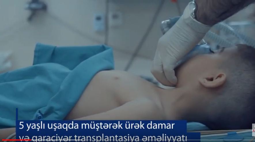 Azərbaycan səhiyyəsində ilk: 5 yaşlı uşaqda müştərək ürək və qaraciyər əməliyyatı –  Nadir xəstəlik