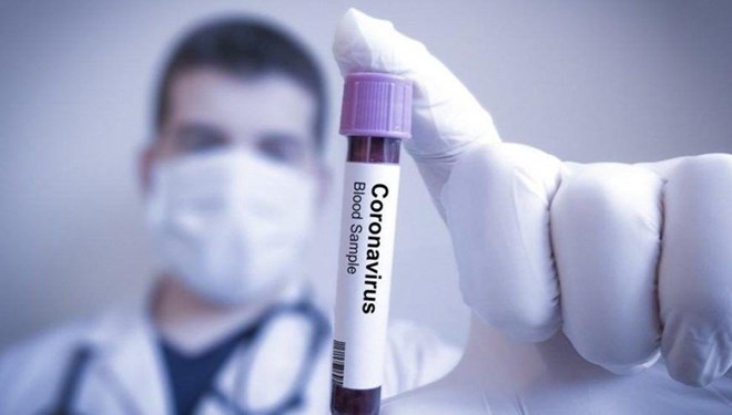 Koronavirus 15 dəqiqəyə aşkarlanacaq-   ALİMLƏR 