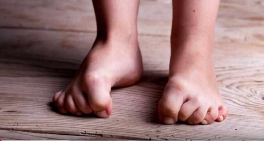 Narahat ayaqlar sindromu üçün RESEPT - Ağrıdan yata bilməyənlərə
