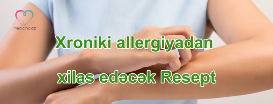 Xroniki allergiyadan xilas edəcək   RESEPT - VİDEO 