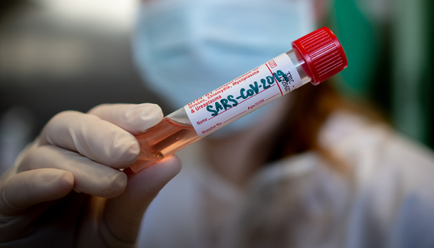 Koronavirus pandemiyasının dayandırılmasının şərtləri -   Bioloq danışır