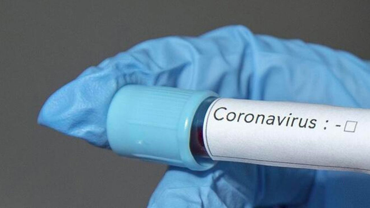 Bu ölkədə də koronavirusdan ilk ölüm qeydə alındı 