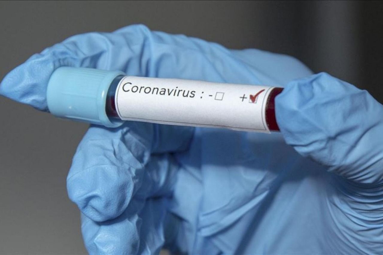 Fransada koronavirusa yoluxan azərbaycanlıların sayı artdı 