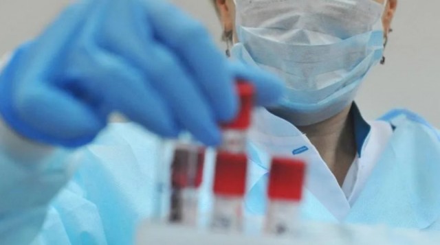 Koronavirus analizlərinin cavabları niyə yubanır?  - TƏBİBDƏN AÇIQLAMA