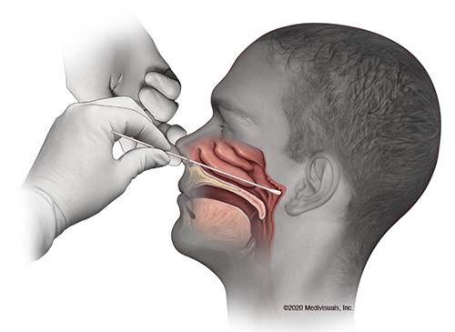 Koronavirus analizi belə götürülür  – Ağrılı prosesdir