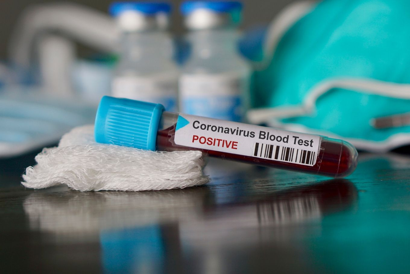 Gürcüstanda koronavirusa 134 nəfər yoluxub 