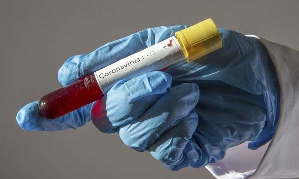 Türkiyədə 500-dən çox insan koronavirusdan öldü 