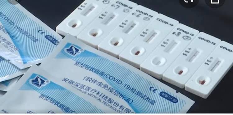 İngiltərənin Çindən aldığı test dəstlərində koronavirus aşkarlandı 