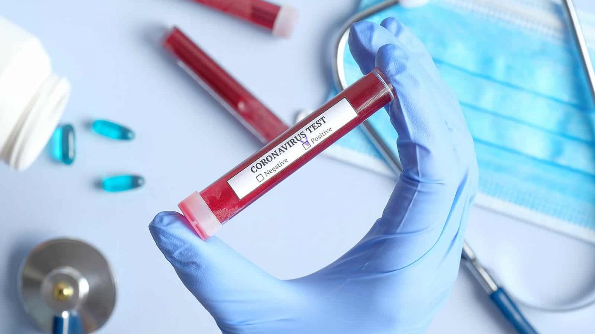 Gürcüstanda koronavirusa yoluxanların sayı artır 