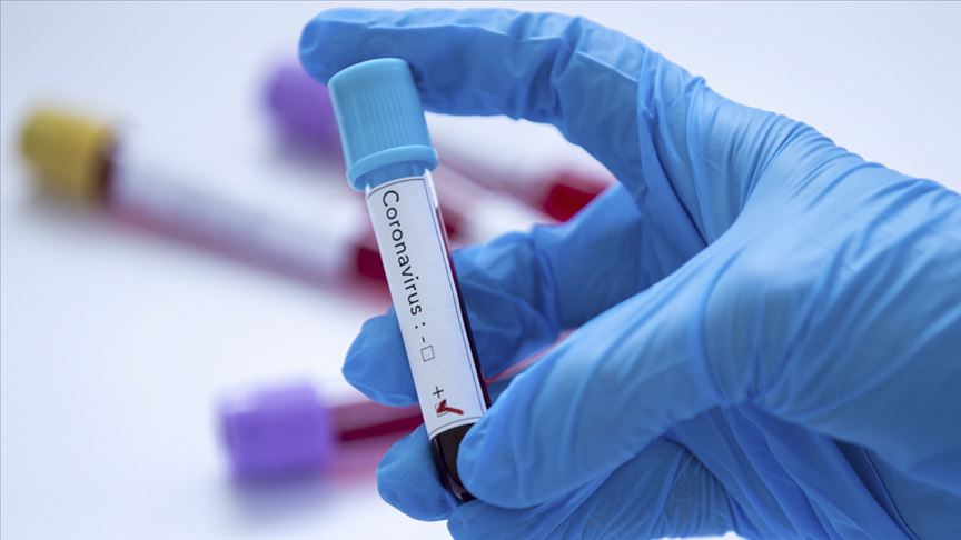 Koronavirus xəstələrinin müalicəsi neçəyə başa gəlir? 
