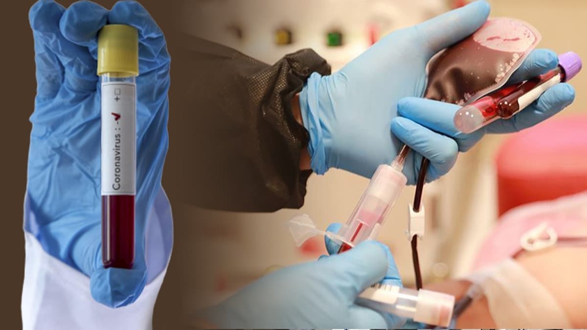 Belarusda virusa yoluxanların sayı 3 minə çatır  