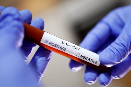 Azərbaycanda daha 49 nəfərdə koronavirus aşkarlandı  - 1 nəfər vəfat etdi