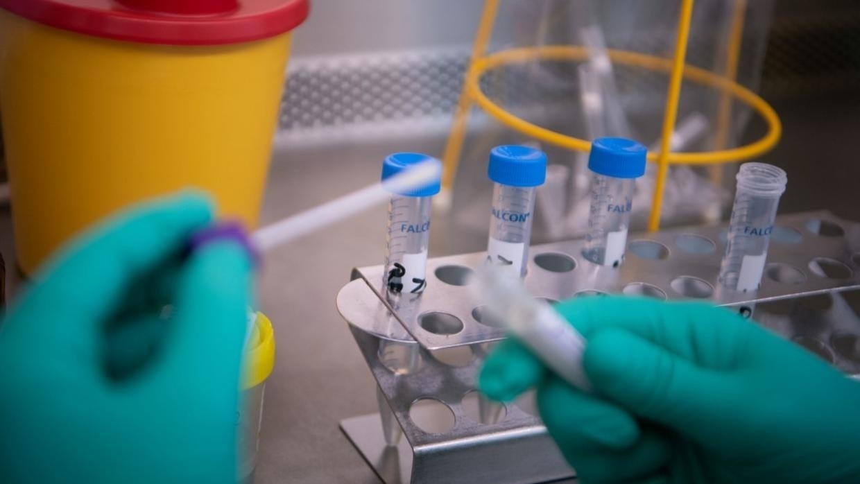 Hindistan şirkətləri koronavirus üçün sürətli test istehsalına başlayacaq  