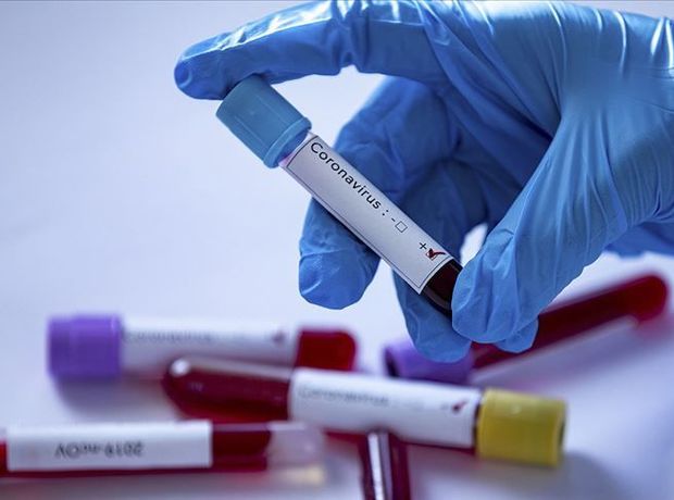 Azərbaycanda daha iki nəfər koronavirusdan öldü, 30 yeni yoluxma aşkarlandı  - RƏSMİ