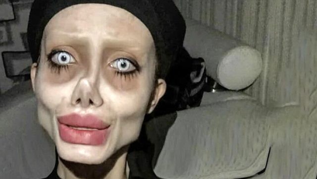 İranlı "zombi qız" da koronavirusa yoluxdu 