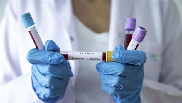 Azərbaycanda 25 yeni yoluxma, 1 ölüm  - Bu günə statistika