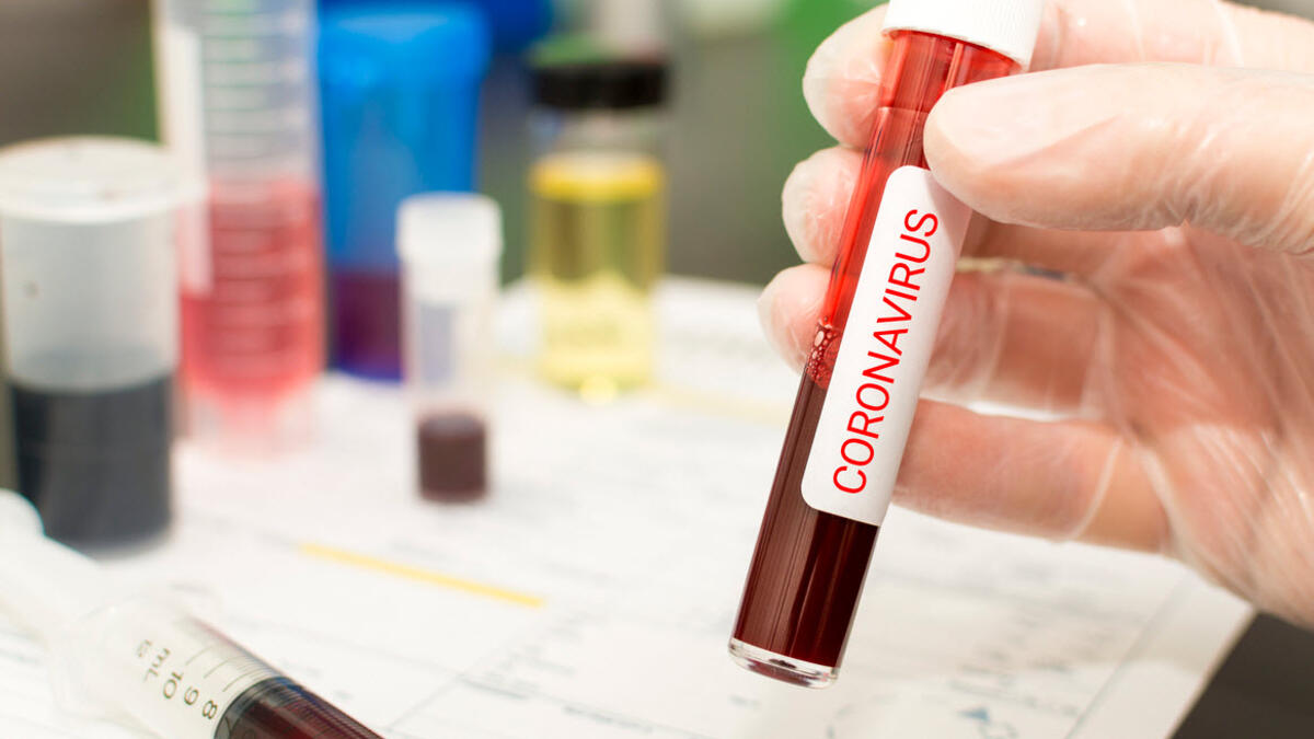 Koronavirusa yoluxanların sayı 4 milyonu keçdi 