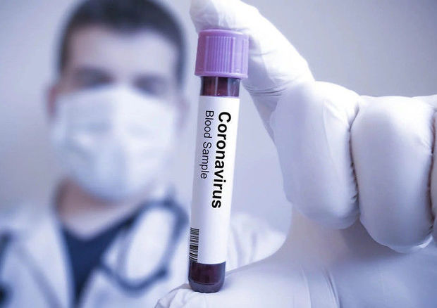 Azərbaycanda koronavirusa 65 yeni yoluxma, 2 ölüm - RƏSMİ
