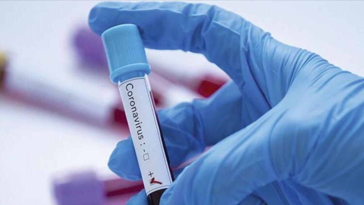Son sutka ərzində dünyada   95 mindən çox insan koronavirusa yoluxub