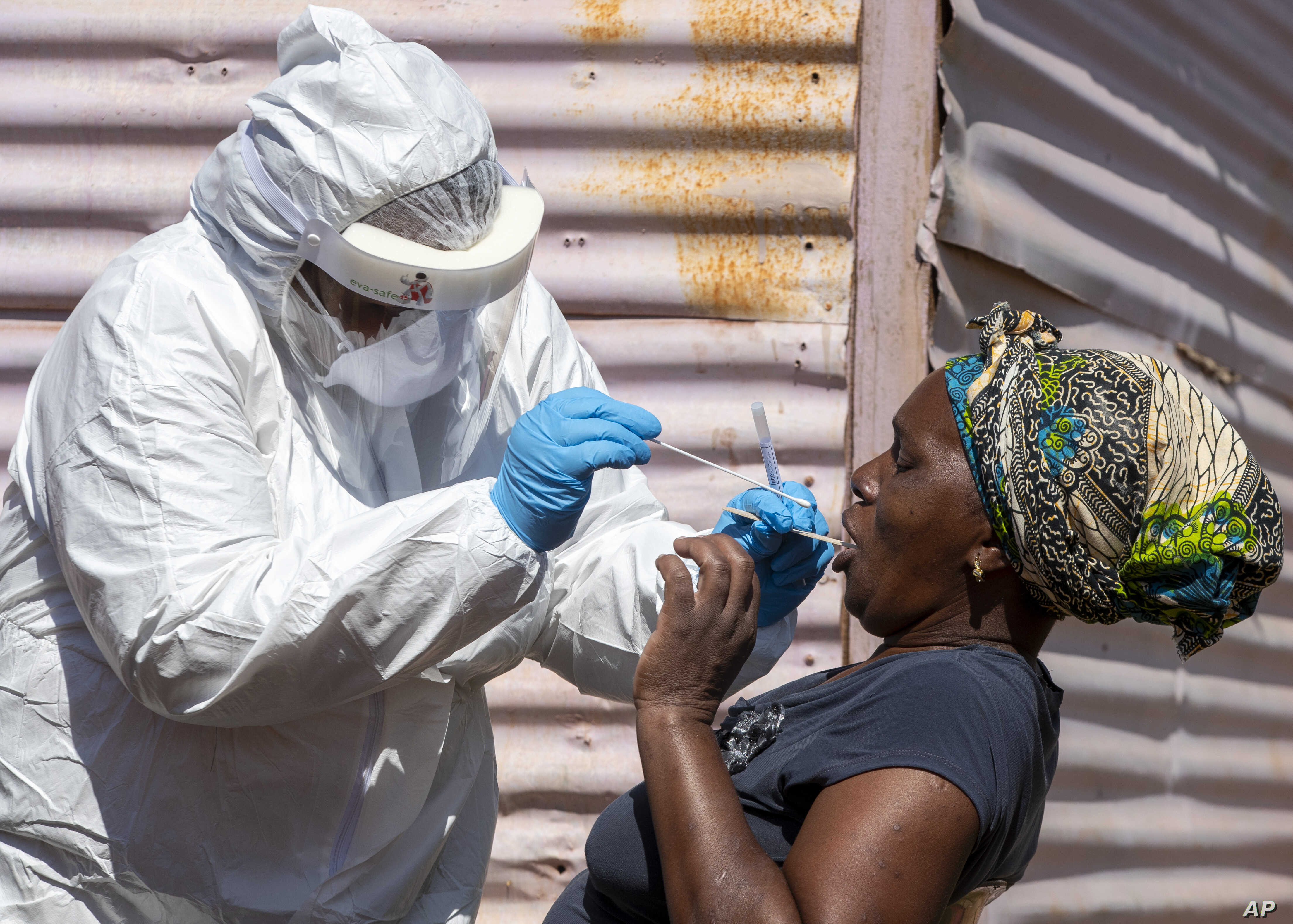 Koronavirus peyvəndinin   afrikalılar üzərində sınanması planlaşdırılır