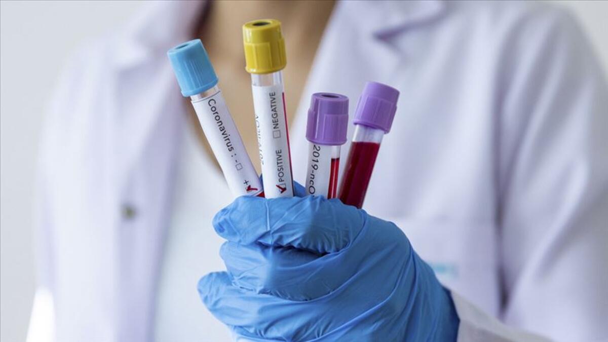 Milli Məclis işçiləri koronavirus testindən keçirilir 