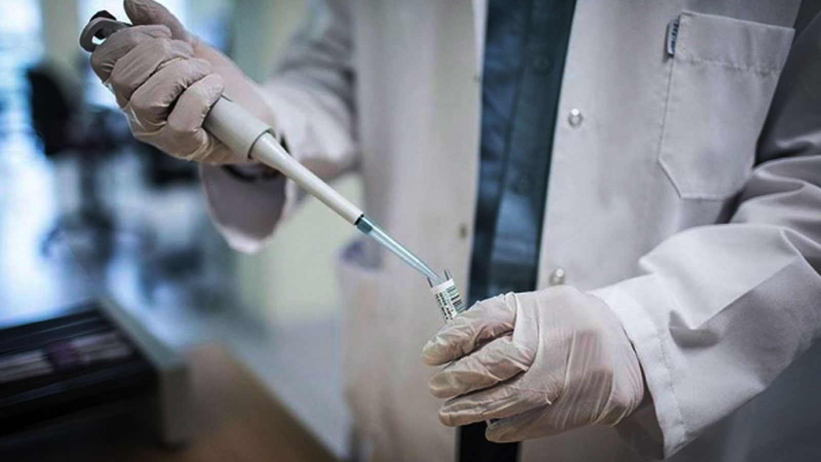 Azərbaycanda bir gündə 6968 nəfər koronavirus testi verdi 
