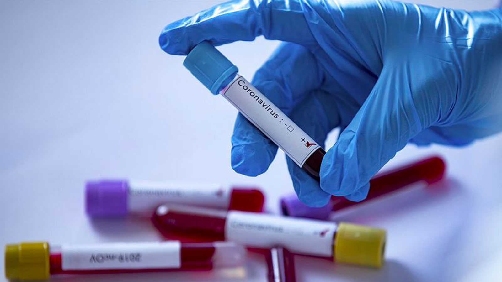 Azərbaycanda koronavirusla bağlı  SON STATİSTİKA