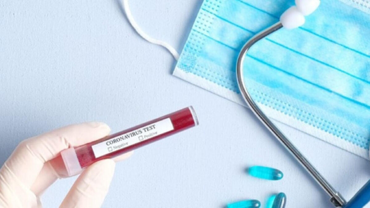 25-26 iyulda koronavirus testlərinin cavabları səhv göndərilib -   RƏSMİ