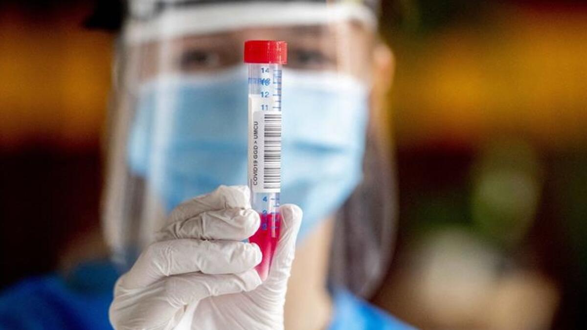 Azərbaycanda daha 87 nəfərdə koronavirus aşkarlandı -  2 nəfər vəfat edib