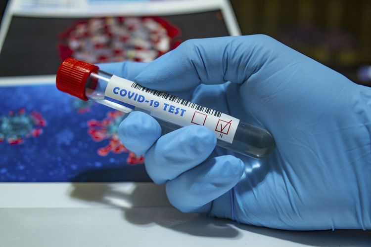 Koronavirusa qarşı ilk peyvənd Rusiyada qeydiyyatdan keçib 