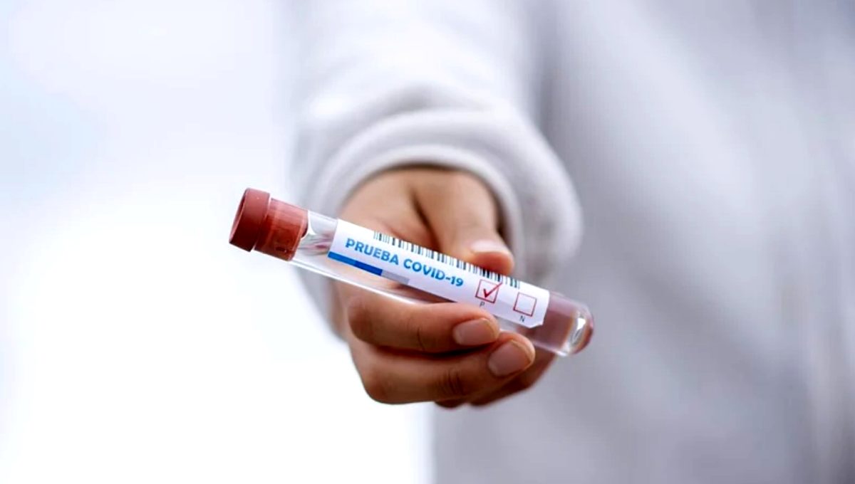 Koronavirusla bağlı  son STATİSTİKA