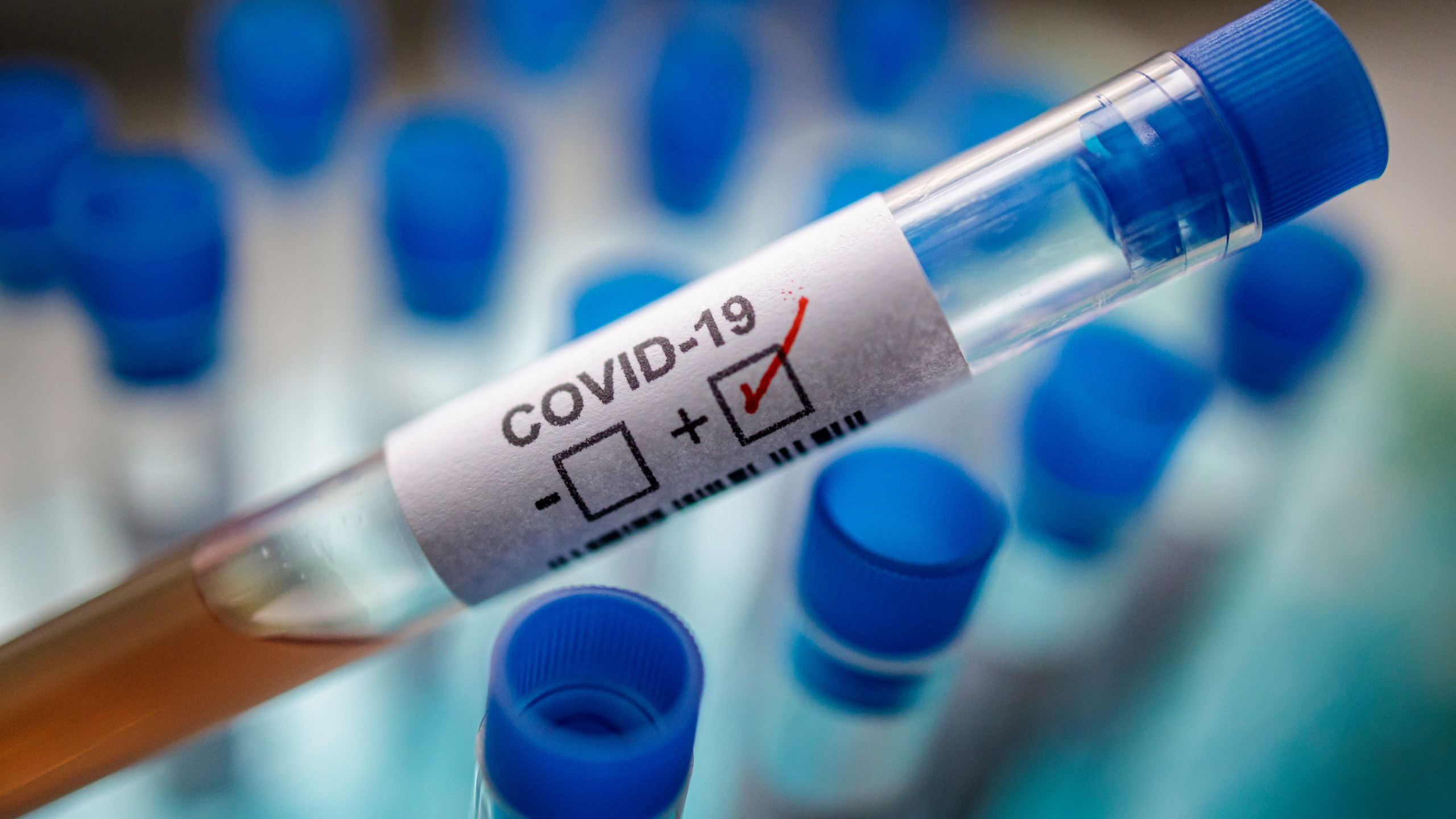 Tramp koronavirusu 15 dəqiqəyə aşkarlayan testi təqdim etdi 