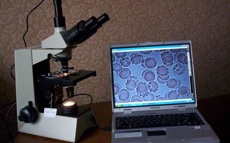 Canlı qan damlasının qaranlıq sahədə mikroskopiyası - Ən dəqiq analiz