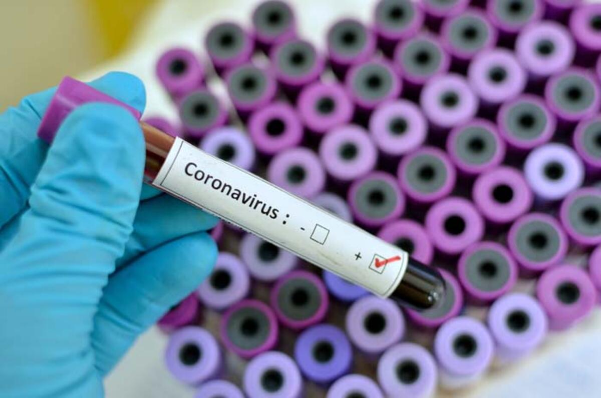Ermənistanda koronavirusa yoluxanların sayı artır 