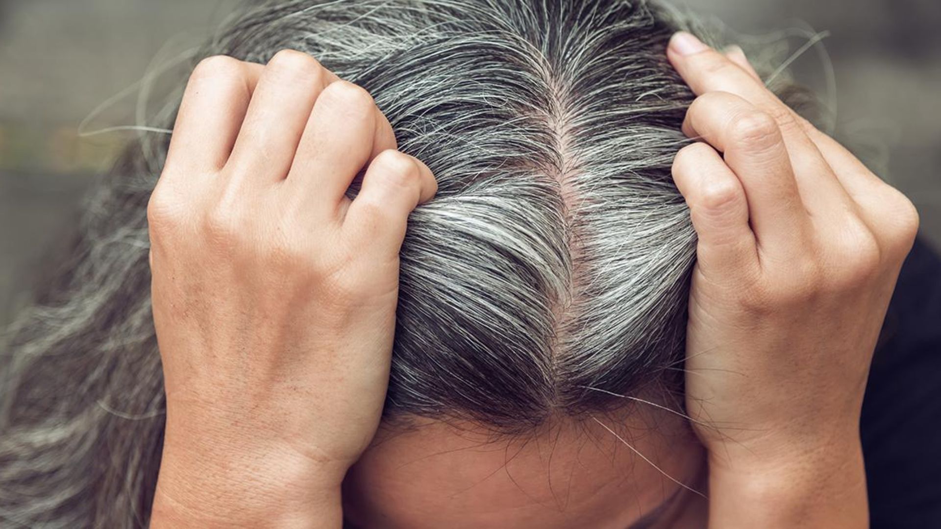 Hansı vitamin çatışmazlığı saç ağarmasına  səbəb olur?