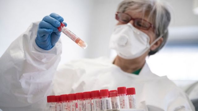 Gürcüstanda koronavirusdan daha 2 nəfər öldü 