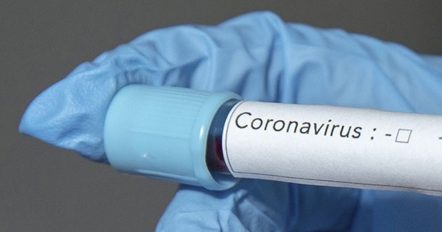 Ermənistanda daha 1 465 nəfərdə koronavirus aşkarlandı 