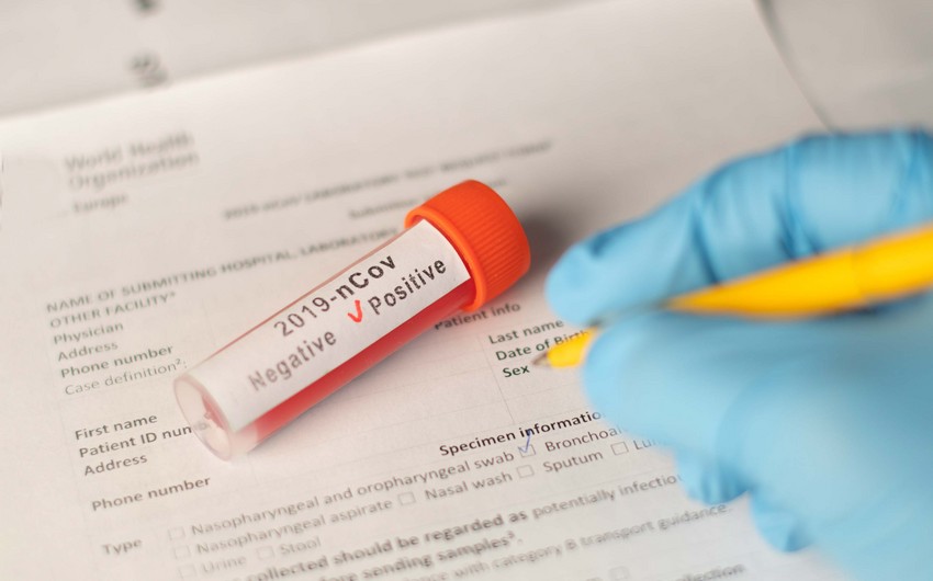Özəl klinikalarda koronavirus testlərinin qiymətləri endirilə bilər?  AÇIQLAMA